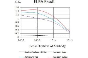 Black line: Control Antigen (100 ng),Purple line: Antigen (10 ng), Blue line: Antigen (50 ng), Red line:Antigen (100 ng) (Macrophage Scavenger Receptor 1 antibody  (AA 275-451))