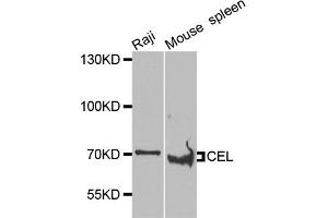 Western blot analysis of extracts of various cell lines, using CEL antibody (ABIN5975616) at 1/1000 dilution. (Cholesterol Esterase antibody)