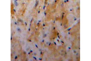 Used in DAB staining on fromalin fixed paraffin-embedded Heart tissue (Galectin 3 antibody  (AA 1-250))