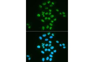 Immunofluorescence analysis of HeLa cells using Bmi1 antibody (ABIN6130877, ABIN6137590, ABIN6137592 and ABIN6217484). (BMI1 antibody  (AA 120-326))