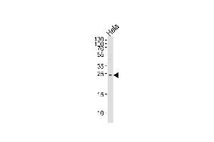 MOB2 antibody  (N-Term)