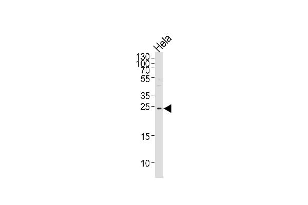 MOB2 anticorps  (N-Term)