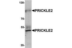Western blot analysis of PRICKLE2 in A-20 lysate with PRICKLE2 antibody at 1 μg/mL.