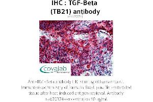 Image no. 2 for anti-TGF-beta (TGFb) antibody (ABIN1723276) (TGF-beta antibody)