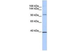 Image no. 1 for anti-RE1-Silencing Transcription Factor (REST) (AA 972-1021) antibody (ABIN6742278) (REST antibody  (AA 972-1021))
