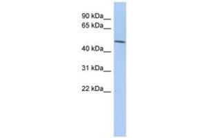 Image no. 1 for anti-Leucine Rich Repeat Containing 42 (LRRC42) (AA 107-156) antibody (ABIN6743647) (LRRC42 antibody  (AA 107-156))