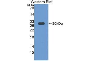 Detection of Recombinant PXN, Mouse using Polyclonal Antibody to Paxillin (PXN) (Paxillin antibody  (AA 347-578))