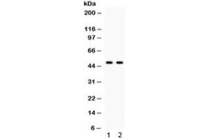 Western blot testing of human 1) HeLa and 2) COLO320 cell lysate with JNK2 antibody. (JNK2 (Alpha/beta) antibody)