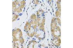 Immunohistochemistry of paraffin-embedded human stomach using STK4 antibody. (STK4 antibody  (AA 303-487))