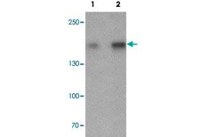 Western blot analysis of Jurkat cell lysate with CRIM2 polyclonal antibody  at (1) 1 and (2) 2 ug/mL. (KCP antibody  (C-Term))