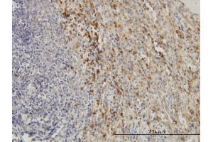 Immunoperoxidase of monoclonal antibody to TIMP2 on formalin-fixed paraffin-embedded human spleen. (TIMP2 antibody  (AA 27-220))