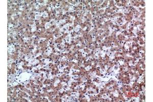 Immunohistochemistry (IHC) image for anti-CD200 (CD200) (Internal Region) antibody (ABIN3187966)