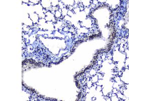 IHC analysis of splicing factor 1 using anti-splicing factor 1 antibody . (Splicing Factor 1 antibody  (AA 160-266))