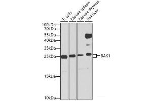 Western blot analysis of extracts of various cell lines using BAK1 Polyclonal Antibody at dilution of 1:1000. (BAK1 antibody)