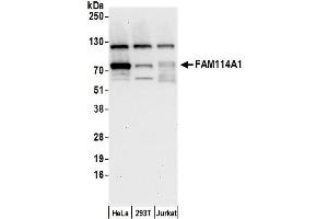 anti-Family with Sequence Similarity 114, Member A1 (FAM114A1) (AA 75-125) antibody