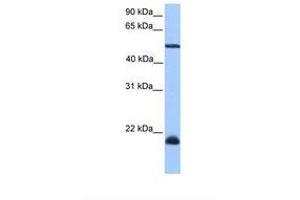 Image no. 1 for anti-Dyslexia Susceptibility 1 Candidate 1 (DYX1C1) (AA 301-350) antibody (ABIN6739367) (DYX1C1 antibody  (AA 301-350))