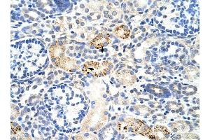 RBM4B antibody was used for immunohistochemistry at a concentration of 4-8 ug/ml to stain Epithelial cells of renal tubule (arrows) in Human Kidney.