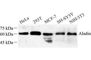 Western blot analysis of Aladin (ABIN7072884) at dilution of 1: 500 (Adracalin antibody)