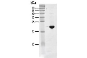 Western Blotting (WB) image for Bromodomain Containing 4 (BRD4) (AA 44-168) protein (His tag,DYKDDDDK Tag) (ABIN2669645)