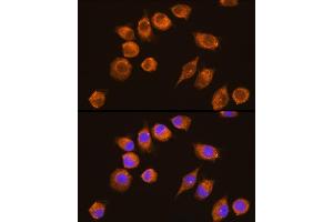 Immunofluorescence analysis of L929 cells using NAGA Rabbit pAb (ABIN6133352, ABIN6144342, ABIN6144343 and ABIN6225273) at dilution of 1:100 (40x lens). (NAGA antibody  (AA 312-411))