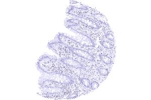 Recombinant TRPS1 antibody  (AA 900-1100)