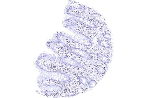 Recombinant TRPS1 antibody  (AA 900-1100)