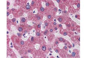 Immunohistochemistry (IHC) image for anti-RHBG (C-Term) antibody (ABIN2783778) (RHBG antibody  (C-Term))