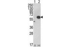 Western blot analysis of AKT1 (arrow) in 293 cell lysates (2 ug/lane) either nontransfected (Lane 1) or transiently transfected with the AKT1 gene (Lane 2) using AKT1 / PKB Antibody (C-term).