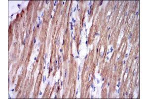 Immunohistochemistry (IHC) image for anti-Fast Skeletal Troponin I (TNNI2) antibody (ABIN969441)