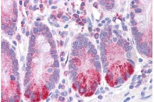 Human Small Intestine: Formalin-Fixed, Paraffin-Embedded (FFPE) (LRRC59 antibody  (N-Term))