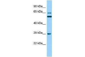 Host: Rabbit Target Name: RAB19 Sample Type: RPMI-8226 Whole Cell lysates Antibody Dilution: 1. (RAB19 antibody  (N-Term))