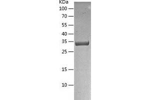 Western Blotting (WB) image for 5'-Nucleotidase, Cytosolic III-Like (NT5C3L) (AA 1-300) protein (His tag) (ABIN7121624)