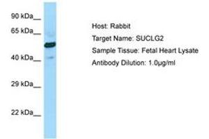 Image no. 1 for anti-Succinate-CoA Ligase, GDP-Forming, beta Subunit (SUCLG2) (AA 258-307) antibody (ABIN6750076) (SUCLG2 antibody  (AA 258-307))