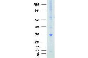 Validation with Western Blot (PIM1 Protein (Myc-DYKDDDDK Tag))