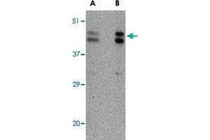 Western blot analysis of FBXL20 in A-20 cell lysate with FBXL20 polyclonal antibody  at (A) 0. (FBXL20 antibody  (C-Term))
