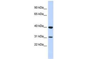 Image no. 1 for anti-Zinc Finger Protein 660 (ZNF660) (N-Term) antibody (ABIN6742930)