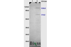 L1 rat heart, L2 rat brain lysates probed (ABIN669636) at 1:200 in 4 °C. (Thrombomodulin antibody)