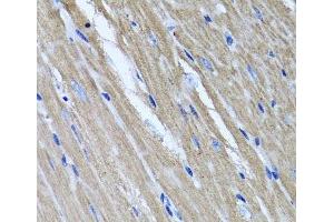 Immunohistochemistry of paraffin-embedded Mouse heart using TNFAIP6 Polyclonal Antibody at dilution of 1:100 (40x lens). (TNFAIP6 antibody)