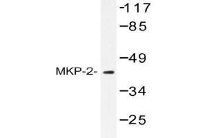 Western blot (WB) analysis of MKP-2 antibody in extracts from RAW264. (DUSP4 antibody)