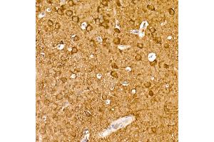 Immunohistochemistry of paraffin-embedded mouse brain using ENO2 Rabbit mAb (ABIN7266959) at dilution of 1:100 (40x lens). (ENO2/NSE antibody)