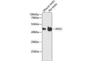 Western blot analysis of extracts of various cell lines using AREG Polyclonal Antibody at dilution of 1:3000. (Amphiregulin antibody)