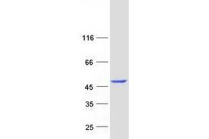 Western Blotting (WB) image for Tocopherol (Alpha) Transfer Protein-Like (TTPAL) (Transcript Variant 1) protein (Myc-DYKDDDDK Tag) (ABIN2734528)
