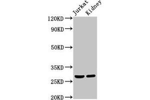 Western Blot Positive WB detected in: Jurkat whole cell lysate, Rat kidney tissue All lanes: MSX2 antibody at 2 μg/mL Secondary Goat polyclonal to rabbit IgG at 1/50000 dilution Predicted band size: 29 kDa Observed band size: 29 kDa
