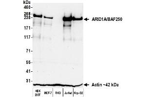Western Blotting (WB) image for anti-AT Rich Interactive Domain 1A (SWI-Like) (ARID1A) (AA 750-800) antibody (ABIN7795677)