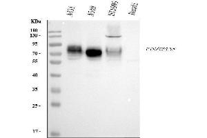 Western blot analysis of Poliovirus Receptor/PVR using anti-Poliovirus Receptor/PVR antibody (ABIN7601072).