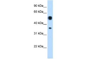ASL antibody used at 0. (ASL antibody  (N-Term))