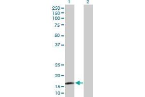 Western Blot analysis of CAMP expression in transfected 293T cell line by CAMP MaxPab polyclonal antibody. (Cathelicidin antibody  (AA 31-170))