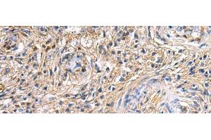 Immunohistochemistry of paraffin-embedded Human brain tissue using SAV1 Polyclonal Antibody at dilution of 1:90(x200) (SAV1 antibody)