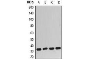 Western blot analysis of IGFBP5 expression in PC3 (A), BT474 (B), mouse kidney (C), mouse lung (D) whole cell lysates.