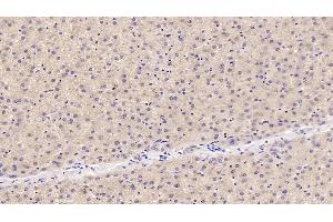 Detection of OAS1 in Human Liver Tissue using Monoclonal Antibody to 2',5'-Oligoadenylate Synthetase 1 (OAS1) (OAS1 antibody  (AA 74-165))